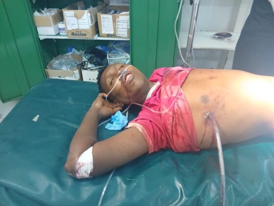 Photos obtained by Kaab TV show the extent of the injuries sustained by civilians who were admitted to various hospitals.